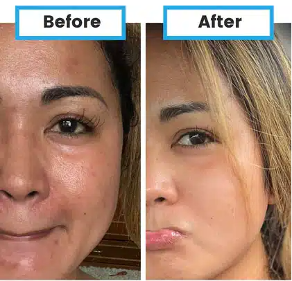 PrimaSkin with HydraStat™ Nano Delivery