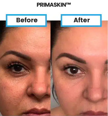 PrimaSkin with HydraStat™ Nano Delivery